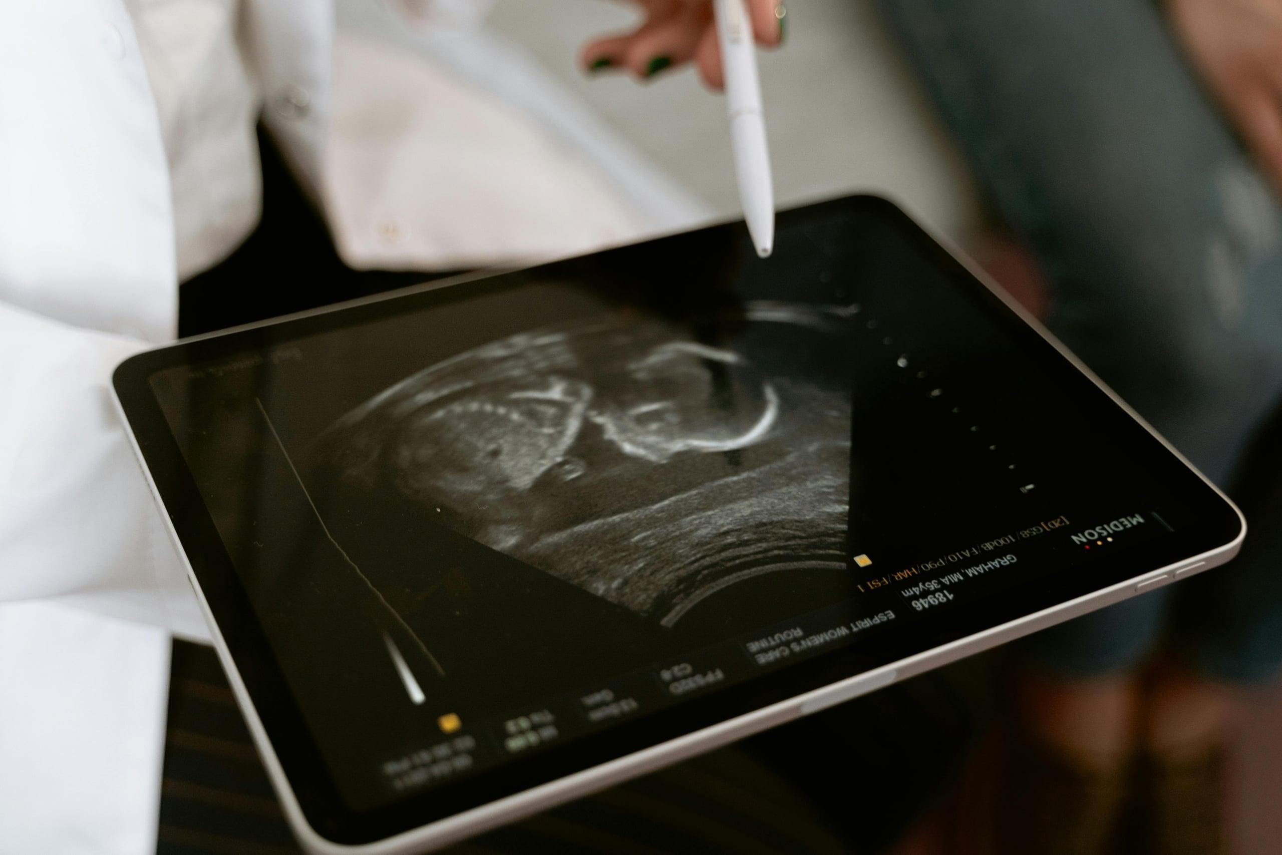 scan hospital